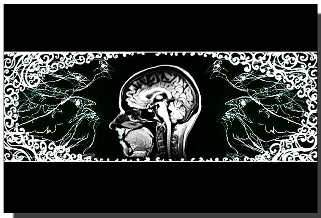Bird Brain